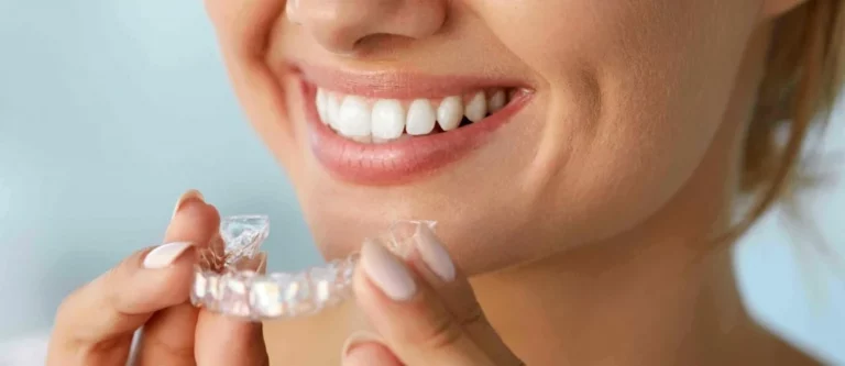 Mutuelle orthodontie adulte